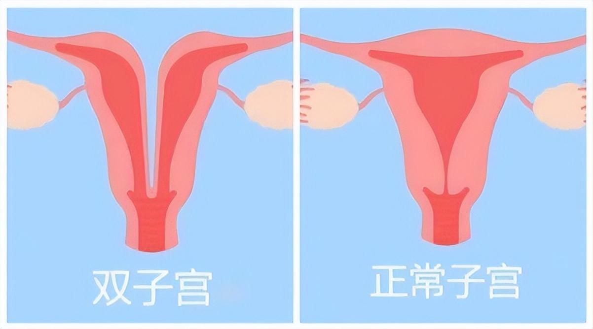 泥猪瓦狗打一准确生肖，详细解答、科学解答解释落实